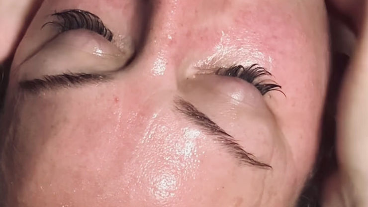 Buccal Massage